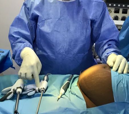 Use of Harmonic Scalpel for Bloodless Surgeries